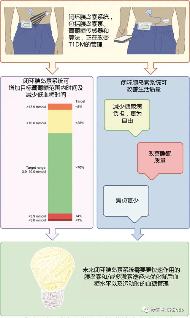 臨床內(nèi)分泌未來篇 - 2021新閉環(huán)胰島素系統(tǒng)-傳感器、胰島素泵和控制系統(tǒng)